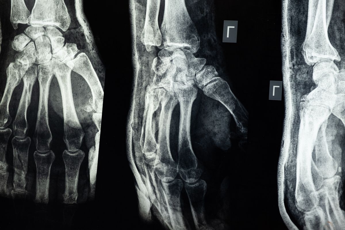 An X-ray image of a human hand, a high-energy type of light